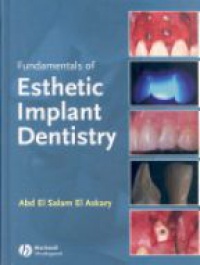 Salam A. - Fundamentals of Esthetic Implant Dentistry