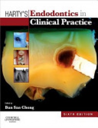 Chong, Bun San - Harty's Endodontics in Clinical Practice