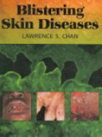 Chan L. - Blistering Skin Diseases