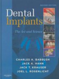 Babbush A. Ch. - Dental Implants