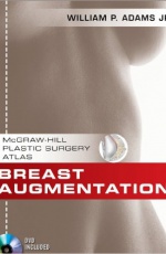 Breast Augmentation: Plastic Surgery Atlas + DVD