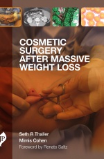 Cosmetic Surgery After Massive Weight Loss