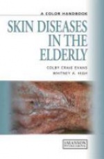 Skin Diseases in the Elderly: A Color Handbook