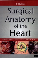 Surgical Anatomy of the Heart