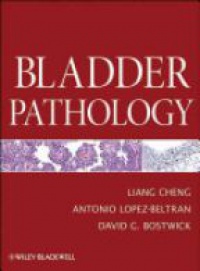 Liang Cheng,Antonio Lopez–Beltran,David G Bostwick - Bladder Pathology