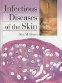 Elston D. - Infectious Diseases of the Skin
