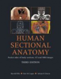 Harold Ellis,Bari M Logan,Adrian K. Dixon - Human Sectional Anatomy: Pocket Atlas of Body Sections, CT and MRI Images