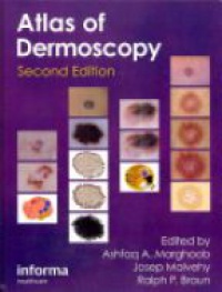 Ashfaq A Marghoob,Josep Malvehy,Ralph P Braun - An Atlas of Dermoscopy