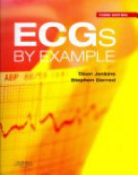 Jenkins D. - ECGs by Example