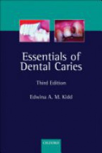 Kidd E.A. - Essentials of Dental Caries