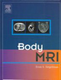 Siegelman S.E. - Body MRI