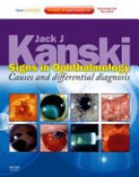 Kanski, Jack J. - Signs in Ophthalmology: Causes and Differential Diagnosis