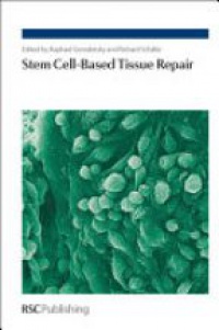 Raphael Gorodetsky,Richard Schäfer - Stem Cell-Based Tissue Repair