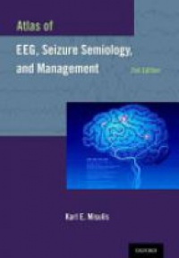 Publisher: Oxford University Press, USA; 2 edition (October 16, 2013) - Atlas of EEG, Seizure Semiology, and Management 