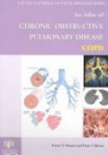 Atlas of Chronic Obstructive Pulmonary Disease COPD