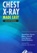Chest X-ray Made Easy