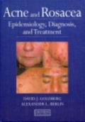 Acne and Rosacea: Epidemiology, Diagnosis and Treatment
