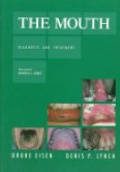The Mouth Diagnosis and Treatment