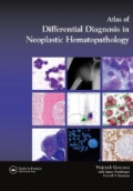 Atlas of Differential Diagnosis in Neoplastic Hematopathology