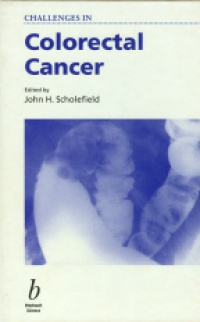 Scholefield J.H. - Challenges in Colorectal Cancer