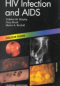 HIV Infection and AIDS