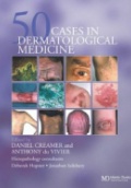 50 Cases Dermatological Medicine