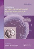 Textbook of in Vitro Fertilization and Assisted Reproduction