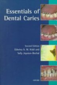 Kidd E. A. - Essentials of  Dental Caries
