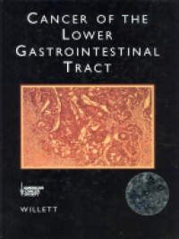 Willett Ch.G. - Cancer of the Lower Gastrointestinal Tract