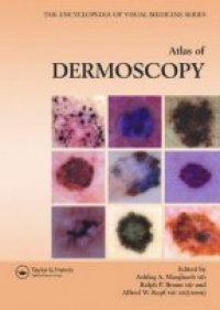 Marghoob A. - Atlas of Dermoscopy