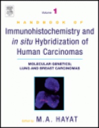 Hayat M. - Handbook Immunohistochemistry and in Situ Hybridization of Human Carcinomas: Molecular Genetics
