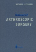 Manual of Arteroscopyc Surgery