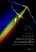Atlas of Multiplane Transesophageal Echocardiography, 2 Vol. Set