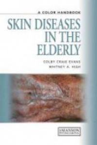 Colby Craig Evans,Whitney A High - Skin Diseases in the Elderly: A Color Handbook