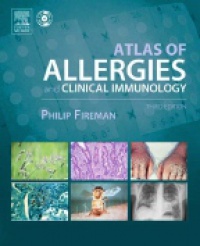 Fireman P. - Atlas of Allergies and Clinical Immunology