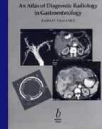 Vallance R. - An Atlas of Diagnostic Radiology in Gastroenterology