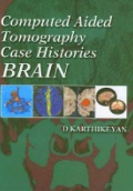 Computed Aided Tomography Case Histories Brain