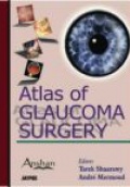 Atlas of Glaucoma Surgery