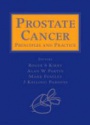 Prostate Cancer: Principles and Practice