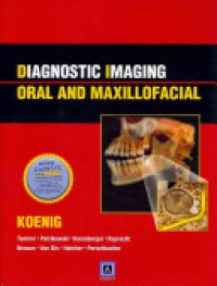 Koenig L. - Diagnostic Imaging: Oral and Maxillofacial