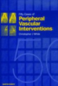 White Ch. J. - Fifty Cases of  Peripheral Vascular Interventions