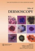 Atlas of Dermoscopy