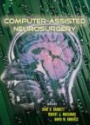 Computer Assisted Neurosurgery