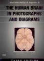 The Human Brain in Photographs and Diagrams with CD-ROM