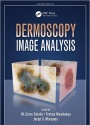 Dermoscopy Image Analysis