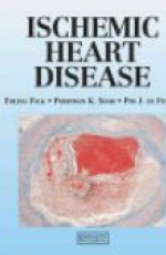 Ischemic Heart Disease