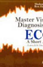 Master Visual Diagnosis of ECG: a Short Atlas (Learn ECG Through ECG)