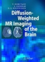 Diffusion - Weighted MR Imaging of the Brain