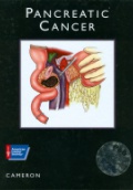 Pancreatic Cancer.  Atlas of Clinical Oncology
