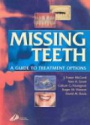 Missing Teeth. A Guide to Treatment Options